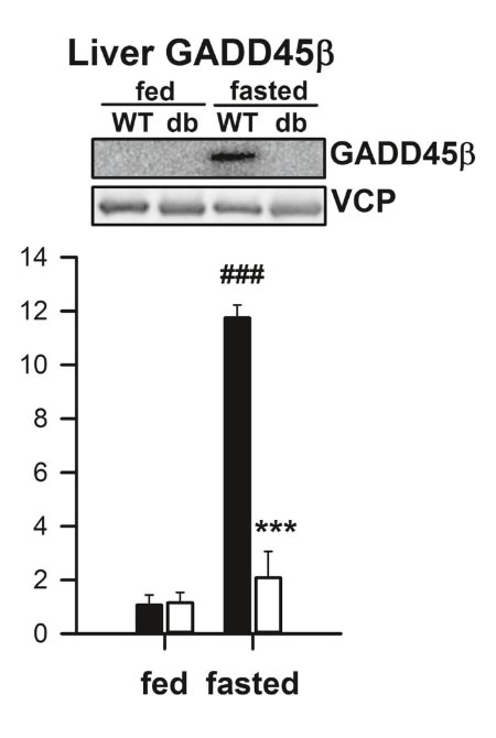 An impressive difference in GADD45β levels in the liver between fasted and fed mice