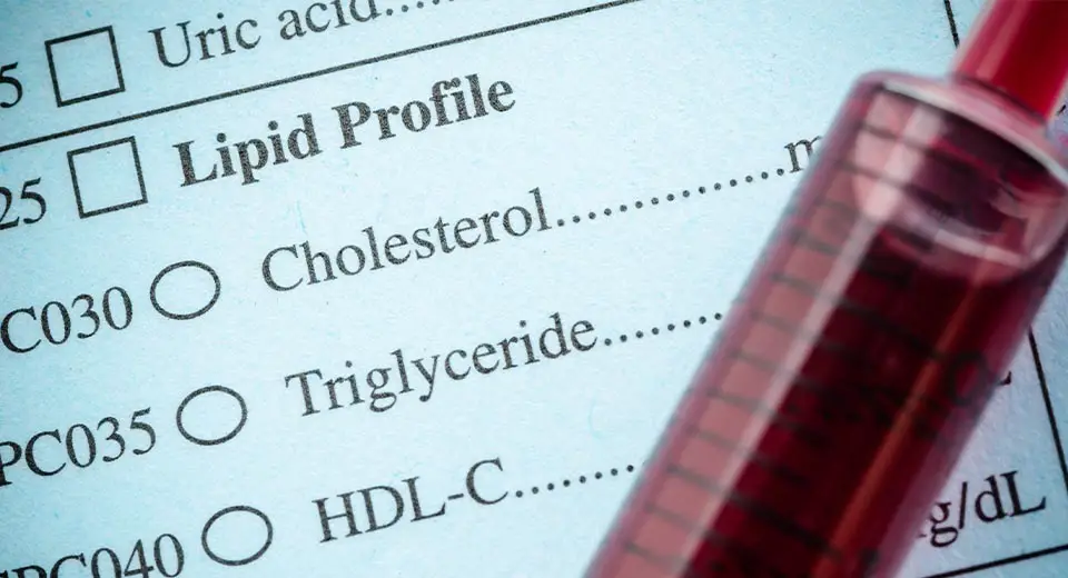 Fasting May Increase LDL Cholesterol Levels